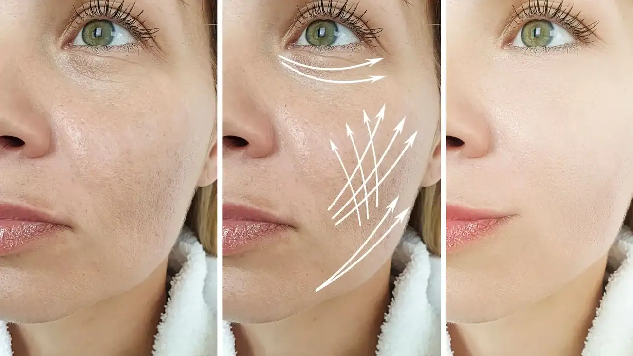 Can One Treatment Really Tackle More Than One Skin Concern Loughborouogh?