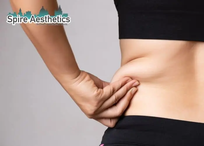 Image of woman pinching fat on their hips Loughborouogh. Fat Freezing treatment 