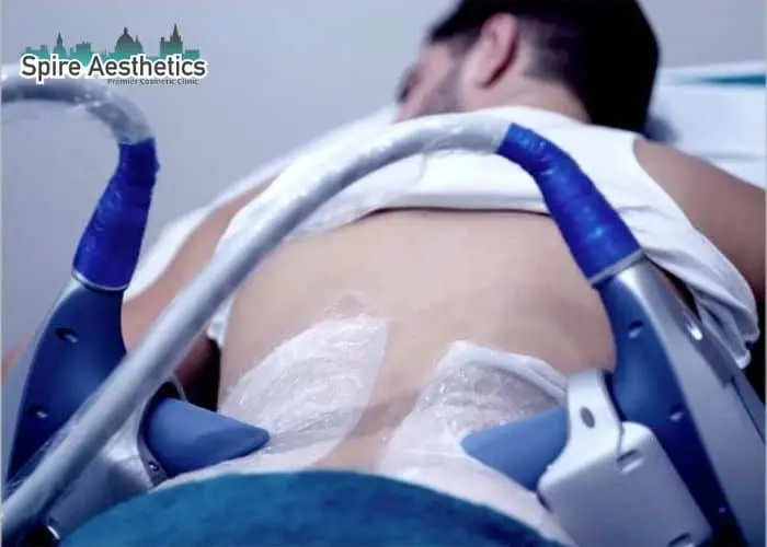 Man having fat freezing treatment done on love handles before a competitions Loughborouogh to create a sculpted look.