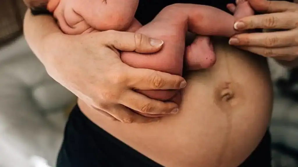 Why Is My Stomach Still Big After Pregnancy Loughborouogh?